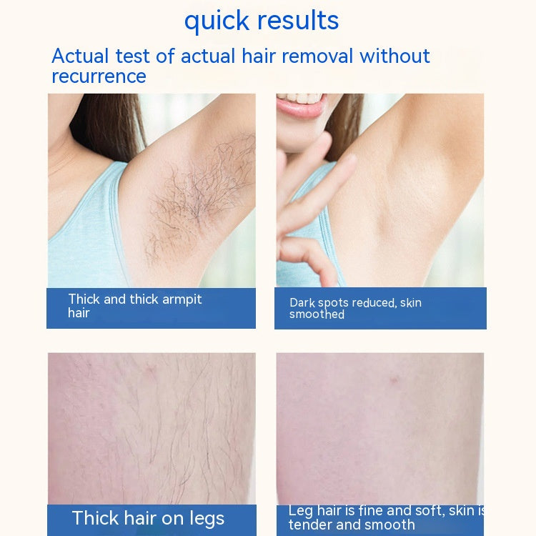 IPL Laser Hair Removal Handset
